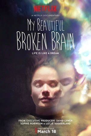 My Beautiful Broken Brain-2016