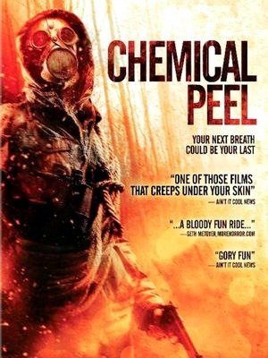 Chemical Peel-2014