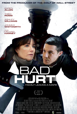 Bad Hurt-2014